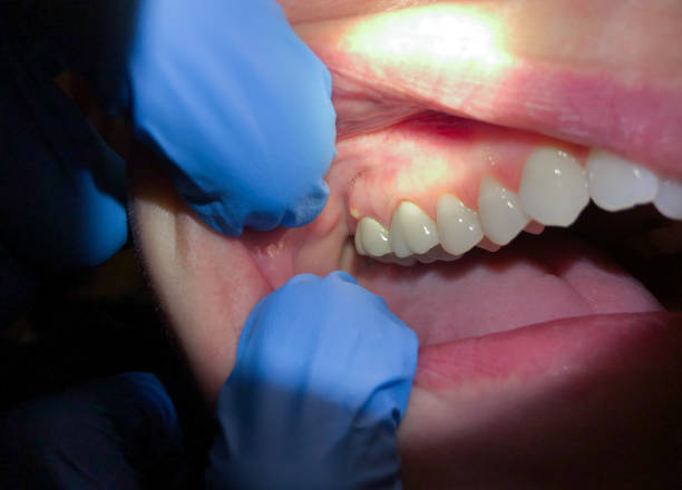 Best Emergency Treatment for Jaw Pain or Injury in Angier, NC