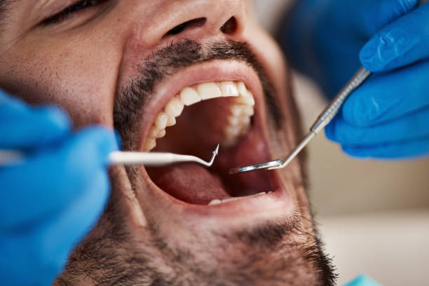  Angier, NC Emergency Dentist Pros